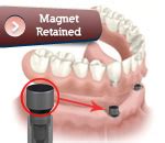  Magnetite: De Magnetische Wonderstof voor Gevorderde Bio-Implantaten en Precisiegeneeskunde!